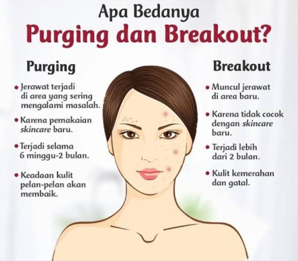 Cara Mengenali ‘Purging’ Vs Breakout: Perbezaan Penting Dalam Penjagaan Kulit